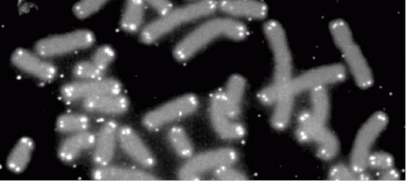 Yasam tarzi degisimi yaslanmayi yavaslatabilir mi?